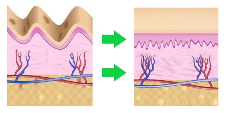 Intenskin aligns the skin